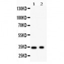 Synaptophysin  Antibody