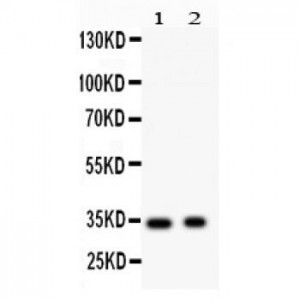 Synaptophysin  Antibody