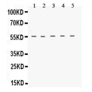 TACR1  Antibody