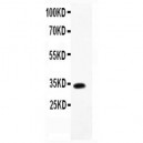 TARC  Antibody