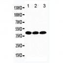 TATA binding protein TBP Antibody