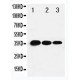 T-bet/Tbx21 Antibody