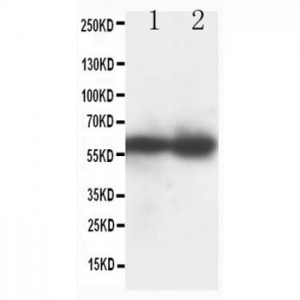 TdT Antibody