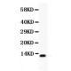 TFF1  Antibody