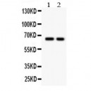 TGF beta Receptor II Antibody