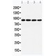 TGM1 Antibody