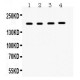 THBS1  Antibody