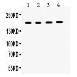 THBS1  Antibody