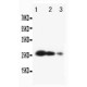 TIMP3 Antibody