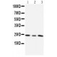 TIMP4 Antibody