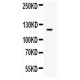 TLR8 Antibody