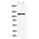 TMEM16A Antibody
