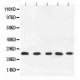 TNF alpha  Antibody