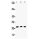 TNF beta Antibody