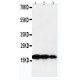 TNF beta Antibody