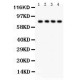 TNF Receptor II  Antibody