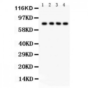 TNF Receptor II  Antibody