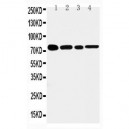 TNF Receptor II Antibody