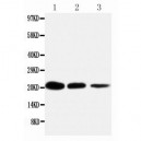 TNFRSF1A Antibody