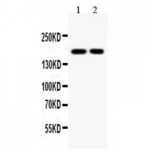 Topoisomerase II alpha Antibody