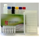 Human Antictrullinated Fibrinogen Antibody CFG.AB ELISA Kit
