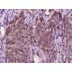 HEPCIDIN 25 POLYCLONAL ANTIBODY