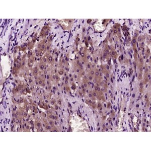 HEPCIDIN 25 POLYCLONAL ANTIBODY
