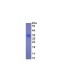 Recombinant Procollagen III N-Terminal Propeptide (PIIINP) 
