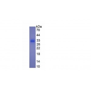 Recombinant Procollagen III N-Terminal Propeptide (PIIINP) 