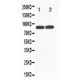 Transferrin Receptor 2 Antibody