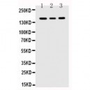 VEGF Receptor 1 Antibody