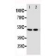 Vitamin D Receptor Antibody