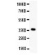 Wnt4 Antibody