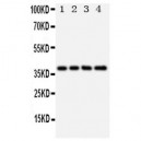 XRCC3 Antibody