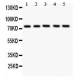 12 Lipoxygenase Antibody