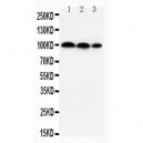 HIF-2-alpha Antibody