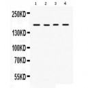 HKDC1  Antibody