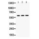 HNF1 beta  Antibody