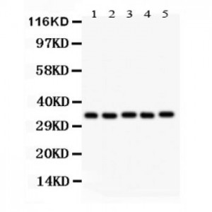 HOXA11  Antibody