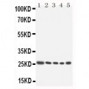 HOXA6 Antibody