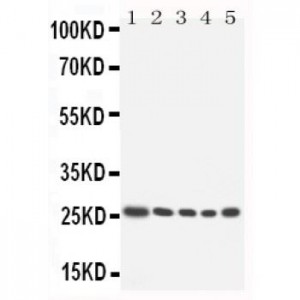 HOXA6 Antibody