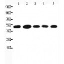 HSC70 Interacting Protein HIP Antibody