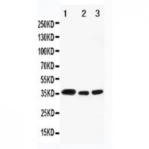 HSD17B1 Antibody