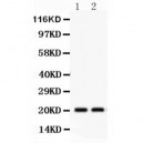 HSPB2  Antibody