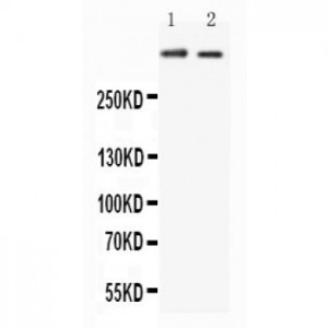 Huntingtin Antibody