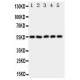 HYAL2 Antibody