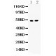 ICA1  Antibody