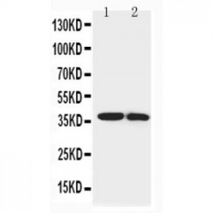 IGFBP1 Antibody