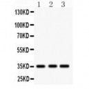 IGFBP2  Antibody