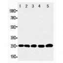 IGFBP6 Antibody